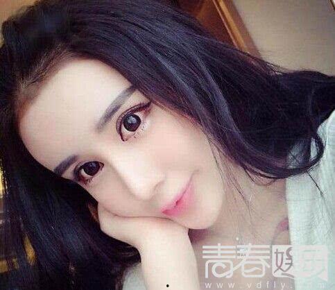 李蒽熙整容前后的照片,整容前后对比，美丽蜕变见证