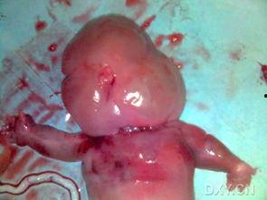 头部囊肿图片,形态、成因及诊断要点